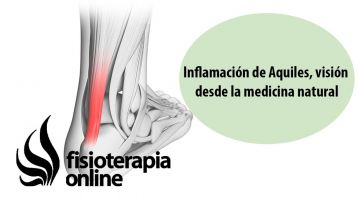 Inflamación o tendinitis de Aquiles, visión desde la medicina natural