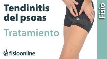 Tendinitis del psoas o psoitis. Tratamiento con ejercicios, auto masajes y estiramientos