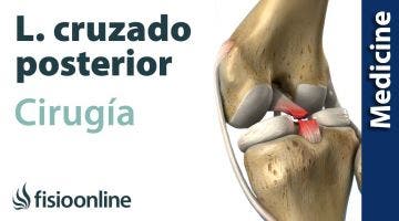 CIRUGÍA del LIGAMENTO CRUZADO POSTERIOR