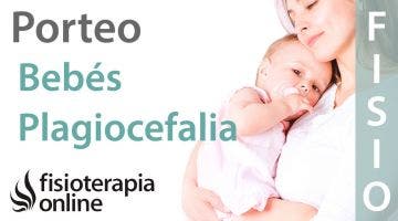 Porteo ergonómico en bebés con plagiocefalia
