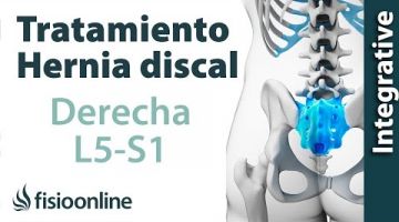 Tratamiento de la hernia discal L5 y S1 derecha y quinta lumbar y sacro