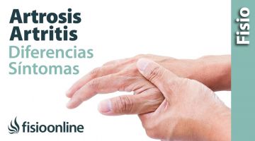 5# Artrosis y Artritis. Qué es, diferencias, causas y síntomas.