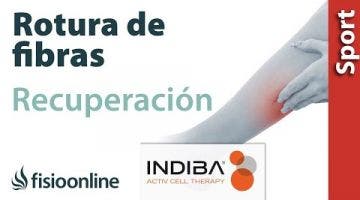 Acelera la recuperación de una rotura de fibras con INDIBA ACTIV