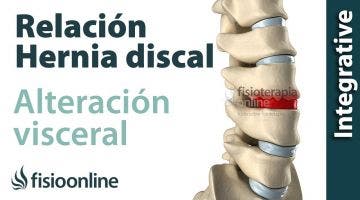 ¿Cómo se produce una hernia discal por una disfunción o alteración visceral?