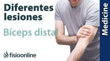 Conoce las diferentes lesiones del Bíceps distal