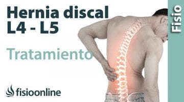 Tratamiento de hernia discal L4 y L5 derecha o cuarta y quinta vértebra lumbar