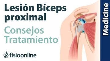 Consejos para el tratamiento de las lesiones del tendón del bíceps proximal