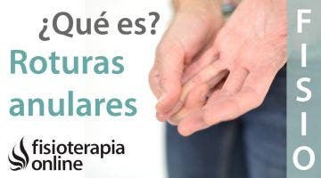 Roturas anulares o del anillo fibroso discal. ¿Qué es?