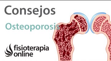 10 Consejos para tratar y prevenir la osteoporosis