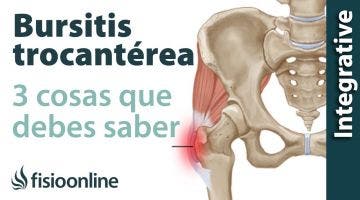 3 cosas que debes saber sobre la trocanteritis o bursitis trocantérea