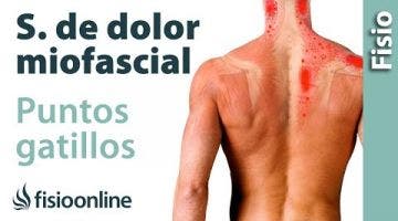 Qué son los PUNTOS GATILLO o síndrome de dolor miofascial y su tratamiento PGM.