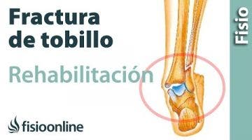 Rehabilitación de fracturas de tobillo con ejercicios, auto masajes y estiramientos