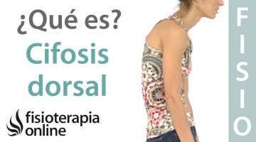 35# Cifosis dorsal. Hipercifosis y dorso plano. Qué son y cual es su importancia.