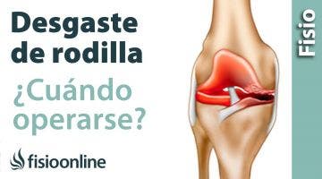 arttrosis de rodilla:  cuándo operarse y pornerse una protesis