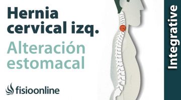 Hernia fiscal cervical izquierda por disfunción de estómago  Plantas medicinales y remedios natura