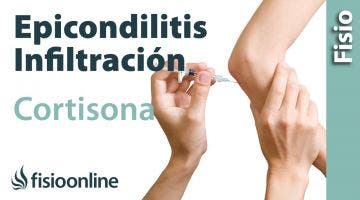 Epicondilitis o codo de tenista y las  infiltraciones de cortisona o corticoides