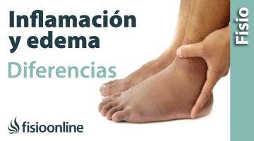 Inflamación y edema - Diferencias y características