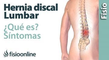 ¿Qué es una hernia discal lumbar y cuáles son sus síntomas y causas?