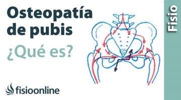 12# Pubalgia u Osteopatia de pubis. Qué es, causas, síntomas y tratamiento.