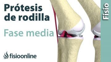 Rehabilitación de Prótesis de Rodilla - Segunda Fase