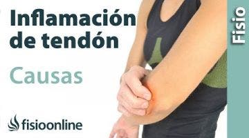 Tendinitis - Como sucede y Cuales son sus causas.