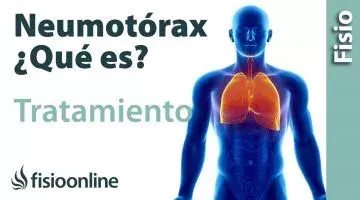 Neumotórax  Qué es, consejos y tratamiento a través de la fisioterapia respiratoria