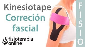 9 Técnica de correción fascial del Kinesiotaping