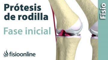 Rehabilitación de Prótesis de Rodilla - Primera Fase