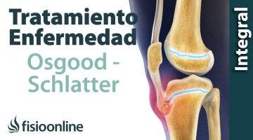 8 Tratamiento de las crecederas o enfermedad OSGOOD SCHLATTER