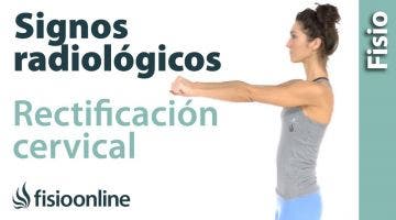 Rectificación cervical e inversión de arco cervical - Signos radiológicos.