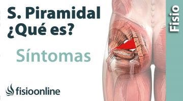 ¿Qué es el síndrome del músculo piramidal y cuáles son sus síntomas y causas?