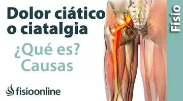 ¿Qué es la ciática o ciatalgia y cuáles son sus causas?