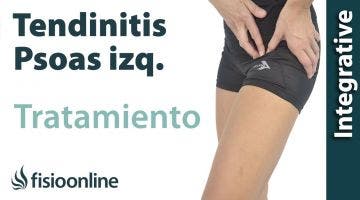 Tratamiento de la tendinitis del paso izquierdo o Psoitis izquierdo