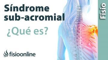 ¿Qué es el síndrome subacromial o síndrome de impactación?