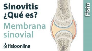 Membrana sinovial y sinovitis. ¿Qué es?