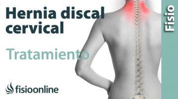 Hernia discal cervical. Tratamiento con ejercicios, auto masajes y estiramientos