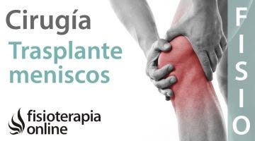 Trasplante meniscal: ¿Es necesario o se puede evitar?