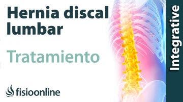 Tratamiento de la hernia discal L5 y S1 izquierda o quinta lumbar y sacro