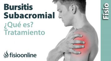 6# Bursitis subacromial en el hombro. Qué es, causas, síntomas y tratamiento.