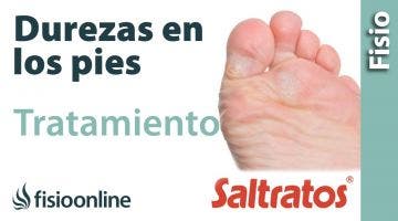 Callos y durezas en los pies. Causas, consejos y tratamiento