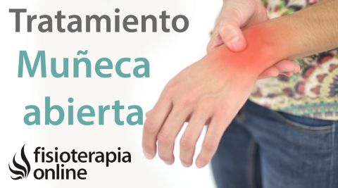 Tratamiento del ganglión de muñeca o muñeca abierta. | Fisioterapia Online