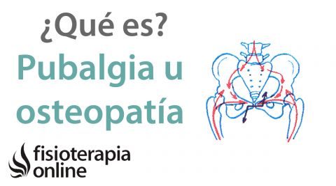 Pubalgia u Osteopatia de pubis ¿Qué es? | Fisioterapia Online