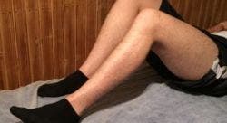 ejercicios protesis de rodilla 5