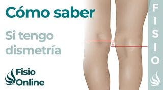 Cómo saber si tienes una PIERNA más CORTA o Dismetría