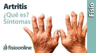 45# Artritis o inflamación articular. Qué es, causas, síntomas y tratamiento.