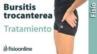 Trocanteritis o bursitis trocanterea. Ejercicios, auto- masajes y estiramientos