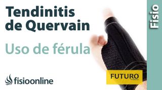 Tendinitis o tenosinivitis de De Quervain - Cómo, cuándo y por qué utilizar férula