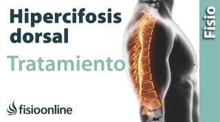 Cifósis dorsal. Tratamiento medianta ejercicios auto masajes y estiramientos