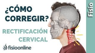 Los 3 MEJORES EJERCICIOS para la RECTIFICACIÓN CERVICAL