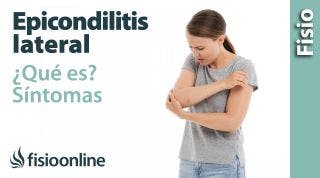2 Epicondilitis lateral o codo de tenista. Qué es, causas, síntomas y tratamiento.